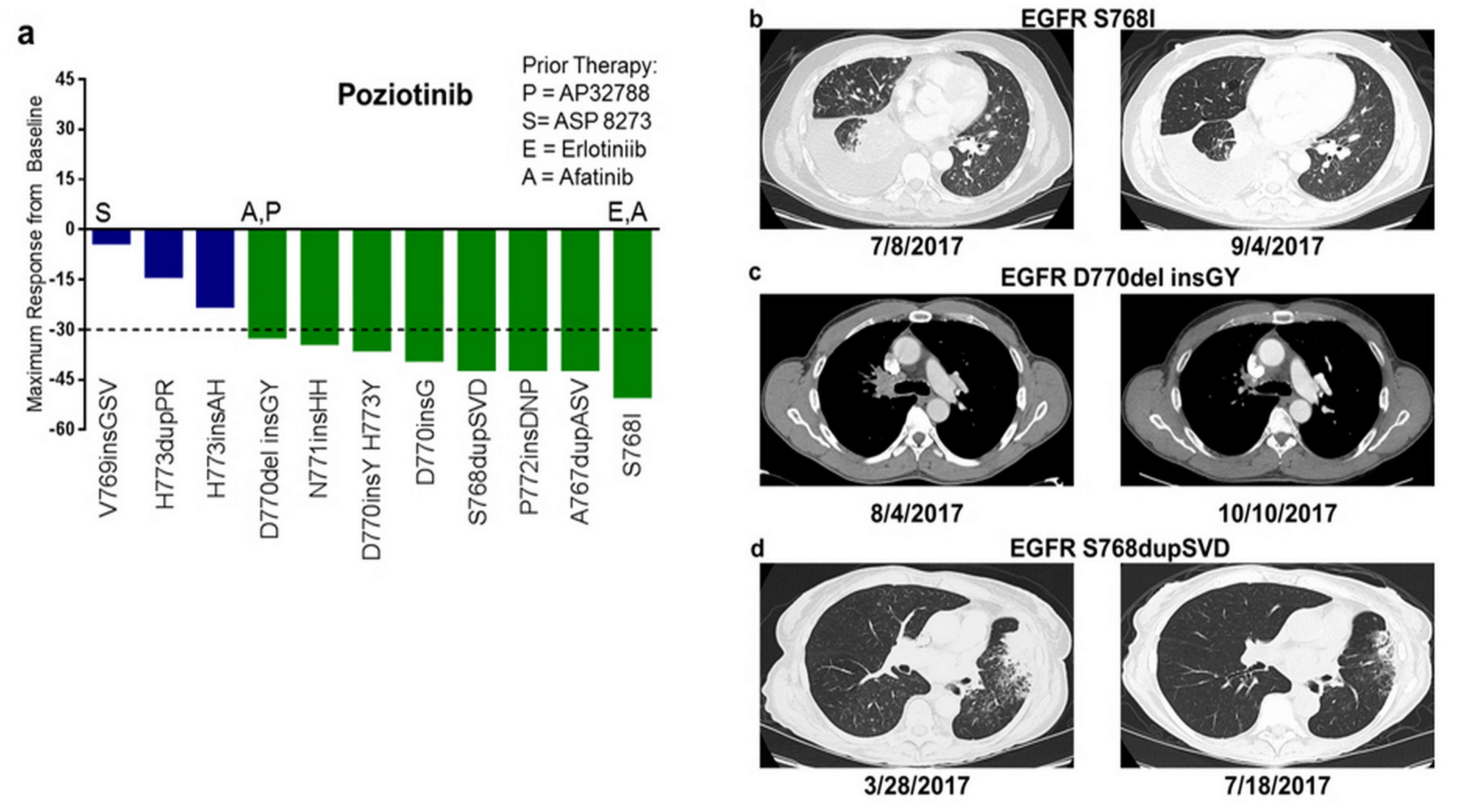 Poziotinib for EGFR Exon-20 Insertions